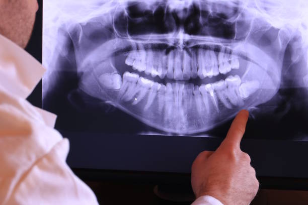 Best Dentist for Severe Toothache  in Caddo Mills, TX