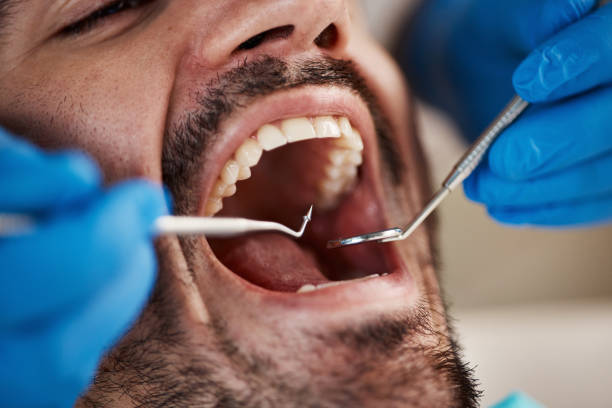 Best Cracked Tooth Emergency Dentist  in Caddo Mills, TX